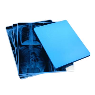 China Dt 2b Mri Films For Fuji Agfa Lucky Hq Printer 14x17 Inch Diagnostic Imaging for sale