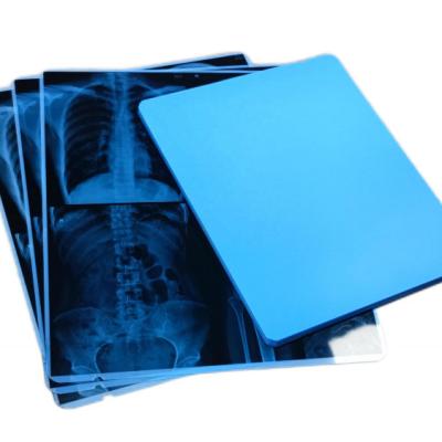 China Dicom Print 10x12 Inch X Ray Dry Film And Screen For Diagnostic Imaging for sale