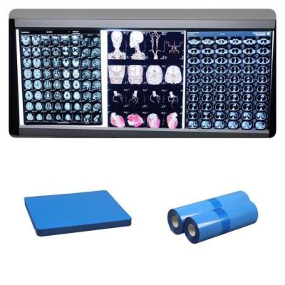China 210microns Medical Inkjet X Ray Films For DR CR 8x10 Inch Blue Base White Base for sale