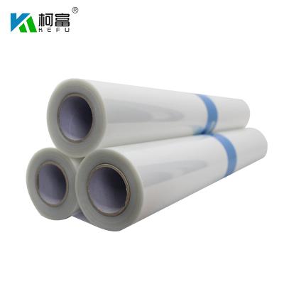 China 5mil 130 Microns Silk Screen Films A4 A3 Color Inkjet Clear Waterproof For HP Epson Printer for sale