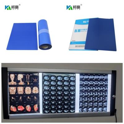China Medical Blue Base Inkjet X Ray Film DR CT MRI Dye Ink 14inch X 125 Sheets Roll 10x12 for sale
