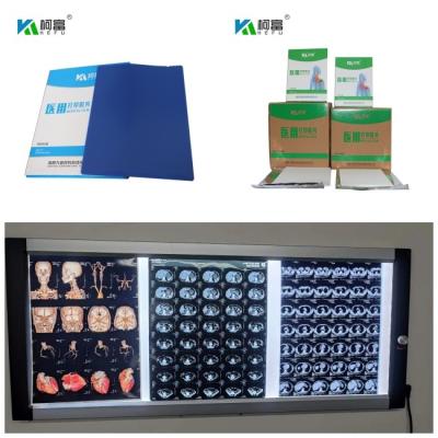 China High Resolution Image Medical X Ray Films 210 Microns Blue Film Thickness Te koop