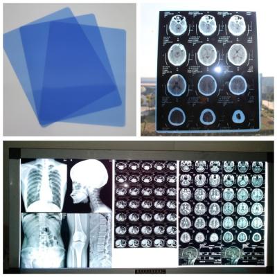 China 210um Inkjet Medical X Ray Film Blue For Digital DR CT MRI Cassette With Sheets 8x10 for sale
