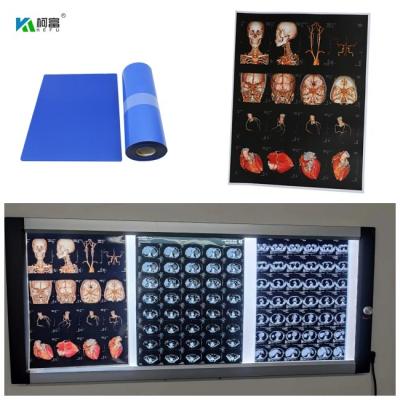 Chine Blue Base Medical Inkjet X Ray Film For Digital Image 280gsm For 14x17inch Color Image à vendre