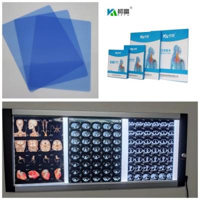 China CT DR MRI Inkjet Medical X Ray Film 3D Image Output 8x10 11x14  14X17 Inch for sale