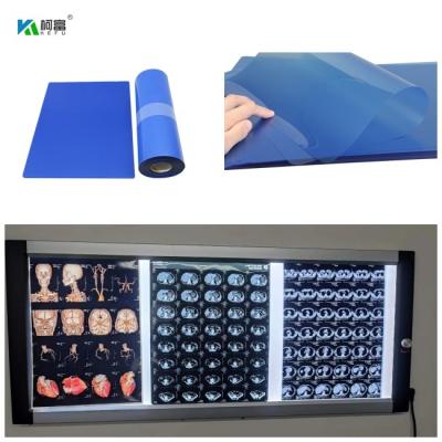 China 210microns Inkjet Medical X Ray Film For CT DR MRI  And 3D CT MRI Image Output 14x17 en venta