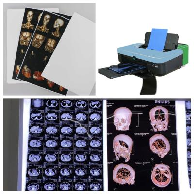 China 9600x2400dpi Inkjet X Ray Film PET Blue Transparent For High Resolution Medical Imaging Te koop
