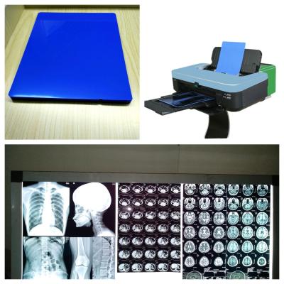 China Inkjet X Ray Film Sheets 8x10 10x12 11x14 14x17 A4 A3 A3+ 13X17 With Printing Speed 1-3 Minutes for sale
