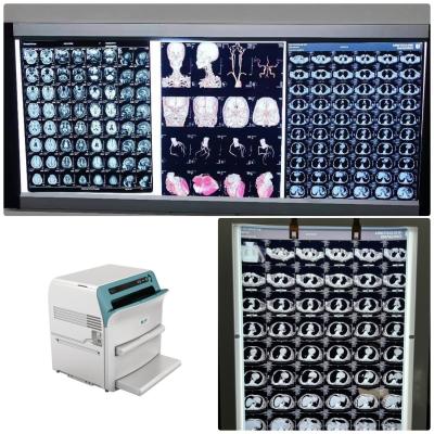 China Low Fog Medical X Ray Film With 320dpi Resolution 14 x 17 on Led X Ray Film View Box for sale