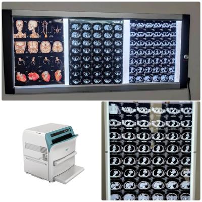 China X de alta resolución médico Ray Dry Film 10x12 para dr System en venta