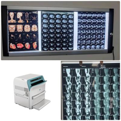 China Class I Medical X Ray Film Radiology 14*17 Inch Hospital Blue Thermal Film for sale