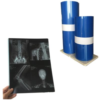 中国 200±5μM Thickness Medical X Ray Film With High Sharpness And Low Fog Level 販売のため