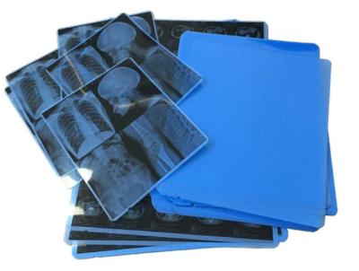 China A4 Blue Medical X Ray Film Dry Clear Inkjet Waterproof For Printer for sale