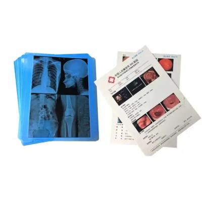 China High Image Stability Inkjet X Ray Film for Glossy Surface Finish in Radiology Imaging en venta