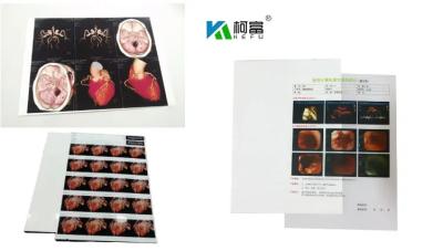 China 204±8 μM Thickness Medical Dry Film With High Durability ≤20% Haze UV Resistance à venda