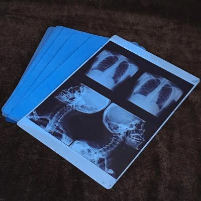 China High Printing Inkjet X Ray Film Blue Film Thickness 210 Microns Blue Transparent Te koop