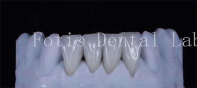 China Dentes finos de revestimento sintético laminado 0,3-0,5 mm espessura à venda
