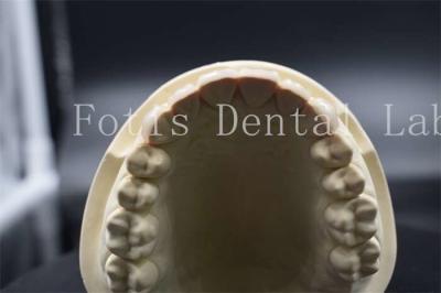 Китай Высокая прочность искусственные зубные фанеры стоматологические фарфоровые фанеры натуральный вид продается