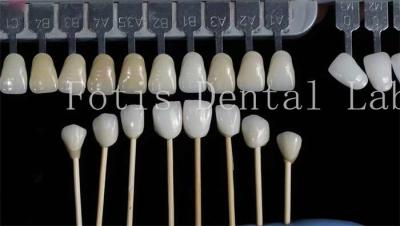 China Customization Natural Dental Veneers Fake Teeth Overlays High Strength for sale