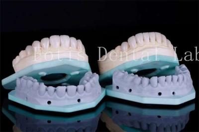 China Vlekbestendige tandheelkundige veneers tandheelkundige kliniek veneers 0,3 mm-0,5 mm Dikte Te koop