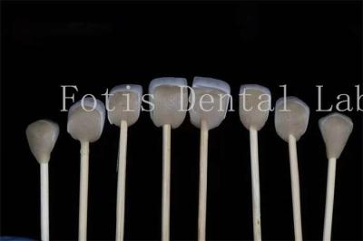China Veneers de laboratório dentário laminados personalizáveis Compatibilidade com várias preparações dentárias à venda
