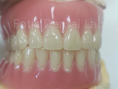China Confort Dentadura de acrílico para prótesis dentales precisas en venta