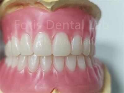 China Durable Natural Color Full Acrylic Denture Odorless Customization for sale