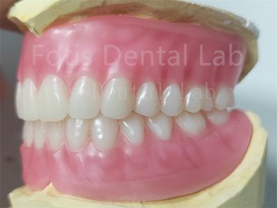 China OEM Full Upper And Lower Acrylic Denture Stain Resistance  Natural Color for sale