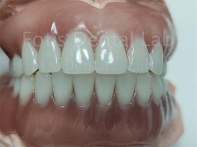 Cina Confortevole protesi dentale acrilica completa superiore protesi dentale acrilica completa con denti ivoclari in vendita