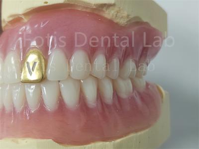 China Customizable Full Denture Acrylic Teeth Odor Resistant Comfort Fit for sale