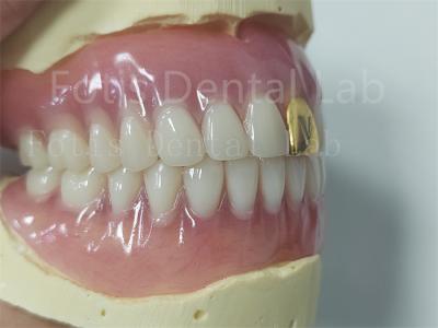 China Esthetics Complete Acrylic Denture Set Customizable Fit Easy To Clean for sale
