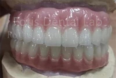 China Dientes de Ivoclar con ajuste preciso Dentes de acrílico con dentadura completa Resistente a manchas en venta