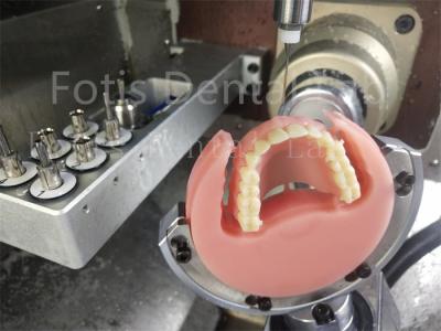 China Ivoclar de color natural con dentadura de acrílico completo confort ajuste de prótesis con estética en venta