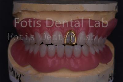 China Técnicos profesionales Dentadura completa acrílica Dentes falsos Prótesis de precisión en venta