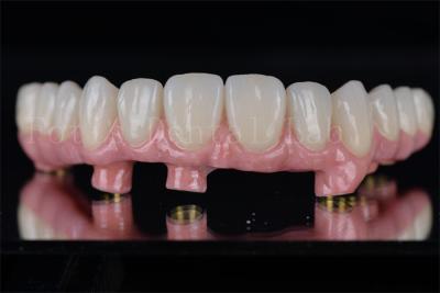 China Individual All On 4 All On 6 Dental Implants Restores Full Chewing Ability for sale