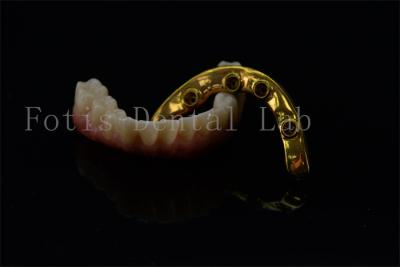 China Titanium Zirconia All On 4 All On 6 Implants Full Smile Implants Lifetime Warranty for sale