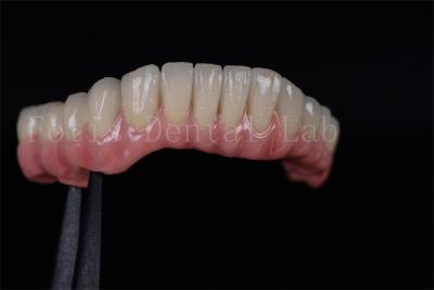 China Alta taxa de sucesso todos em quatro todos em seis Zirconia Titânio implantes dentários personalizados à venda