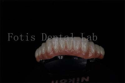 China Full Mouth Restoration All On 4 And All On 6 Titanium Or Zirconia Highly Success Rate for sale