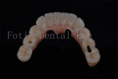China Un aspecto natural en cuatro dientes en un día para cualquier edad disponible en venta