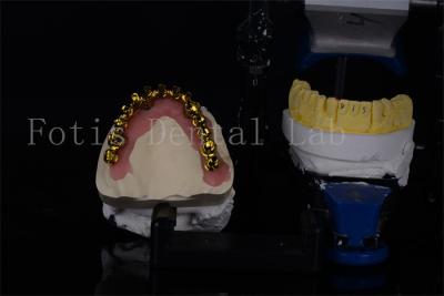 China Affordable Titanium / Zirconia All On 4 Dental Implants For Natural Looking Smiles for sale