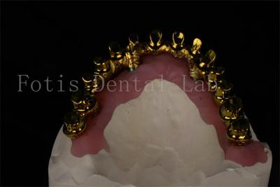 中国 自然 な 見た目 4 6 歯科 インプラント は 噛む 能力 を 回復 さ せる 販売のため