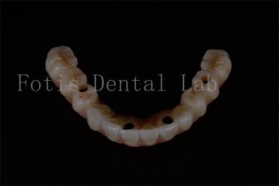 中国 オールオン4 オールオン6 改良歯科インプラントの交換 販売のため