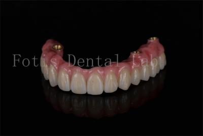 中国 歯科インプラントの最適な性能のために全4つのインプラントで完全なアーチ修復 販売のため