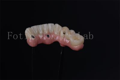 中国 歯のすぐ置換のための個別 オールオン4 オールオン6 エンドステールインプラント 販売のため