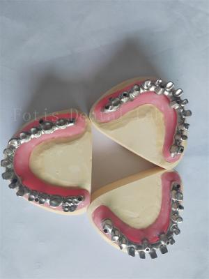 China Customized All On 4 All On 6 The Perfect Solution For Dental Implant Restorations for sale