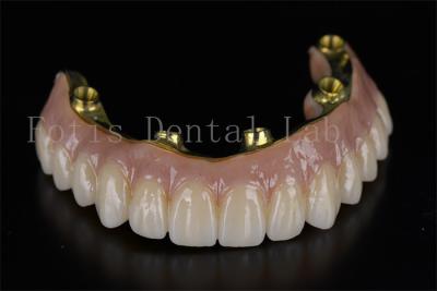 China Professional Efficient Treatment All On 6 Implants For Dental Issues for sale