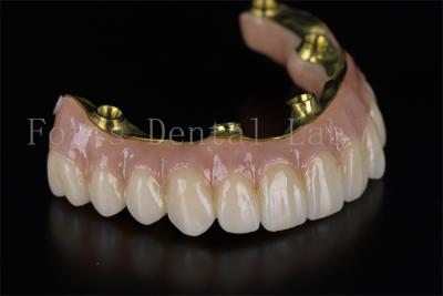 China Full Mouth Reconstruction All On 4 All On 6 Dental Implant System for sale