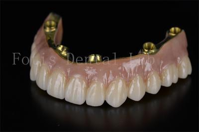 China Full Arch Restoration All On Six Implants Minimally Invasive Solution for sale