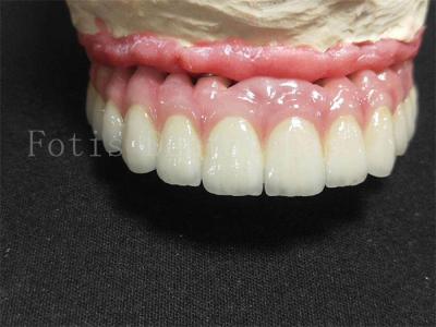 China Corona de implantes de titanio / zirconio de acabado pulido corona dental artificial en venta