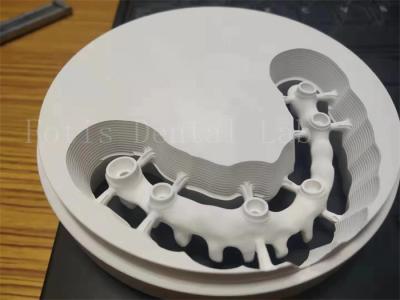 China Implante dental pulido higiénico con corona de zirconia diseño personalizable en venta